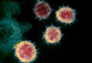 درمان کرونا با پلاسمای بهبودیافتگان به کجا رسید؟